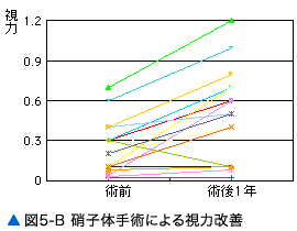 図5-B 硝子体手術による視力改善