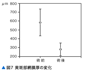 図7 黄斑部網膜厚の変化