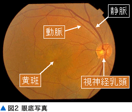 図2 眼底の写真