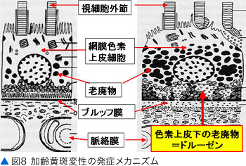 図8 加齢黄斑変性の発症メカニズム